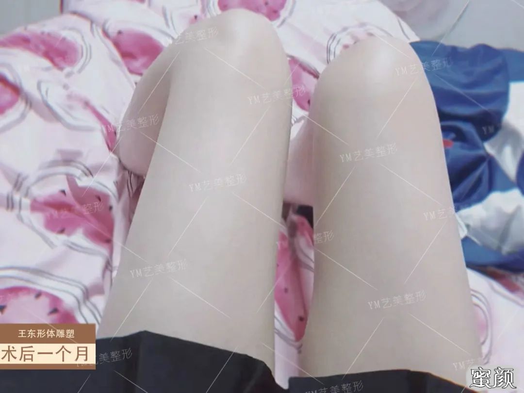 案例图片