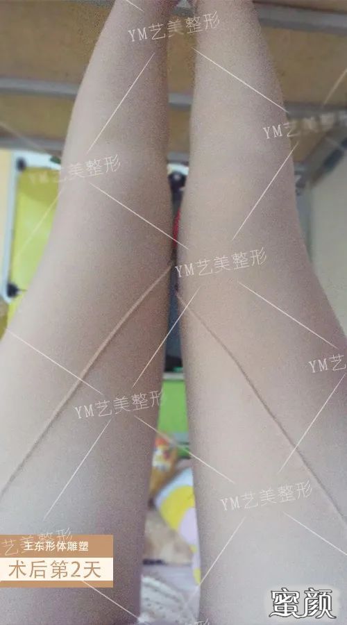 案例图片