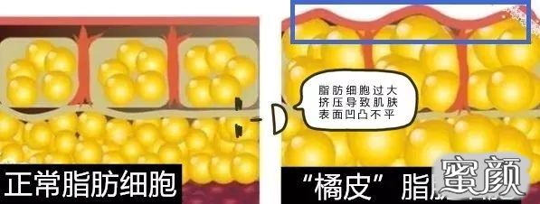 https://img.yiyiaimei.com/mnt/timg/200624/1112334b2-5.jpg 案例图片