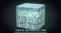 https://img.yiyiaimei.com/mnt/timg/200624/1112343b1-6.jpg 案例图片
