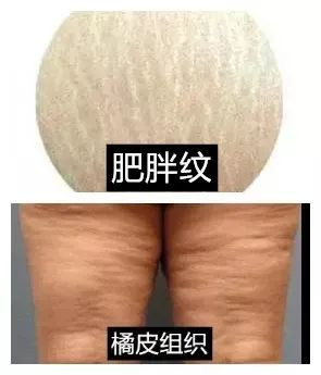 https://img.yiyiaimei.com/mnt/timg/200624/1112344144-8.jpg 案例图片