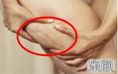 https://img.yiyiaimei.com/mnt/timg/200624/1112345596-7.jpg 案例图片