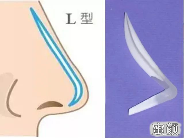 案例图片