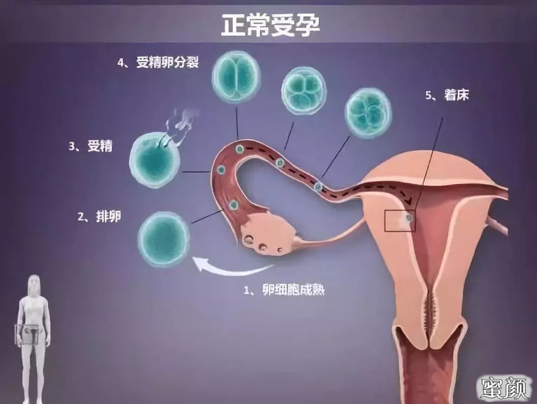 案例图片