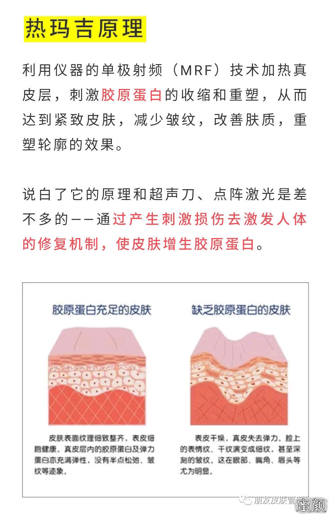 https://img.yiyiaimei.com/mnt/timg/200624/13043151H-0.jpg