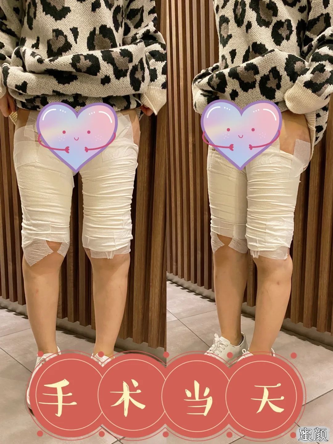 https://img.yiyiaimei.com/mnt/timg/200626/11152SU2-5.jpg 案例图片