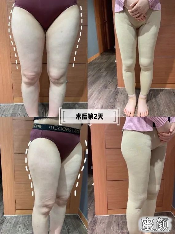 https://img.yiyiaimei.com/mnt/timg/200626/11152T5V-6.jpg 案例图片