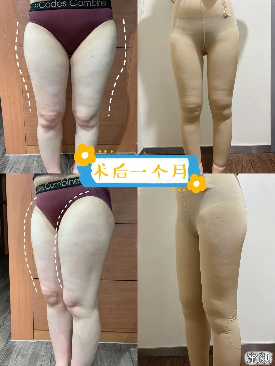 https://img.yiyiaimei.com/mnt/timg/200626/111533O02-9.jpg 案例图片