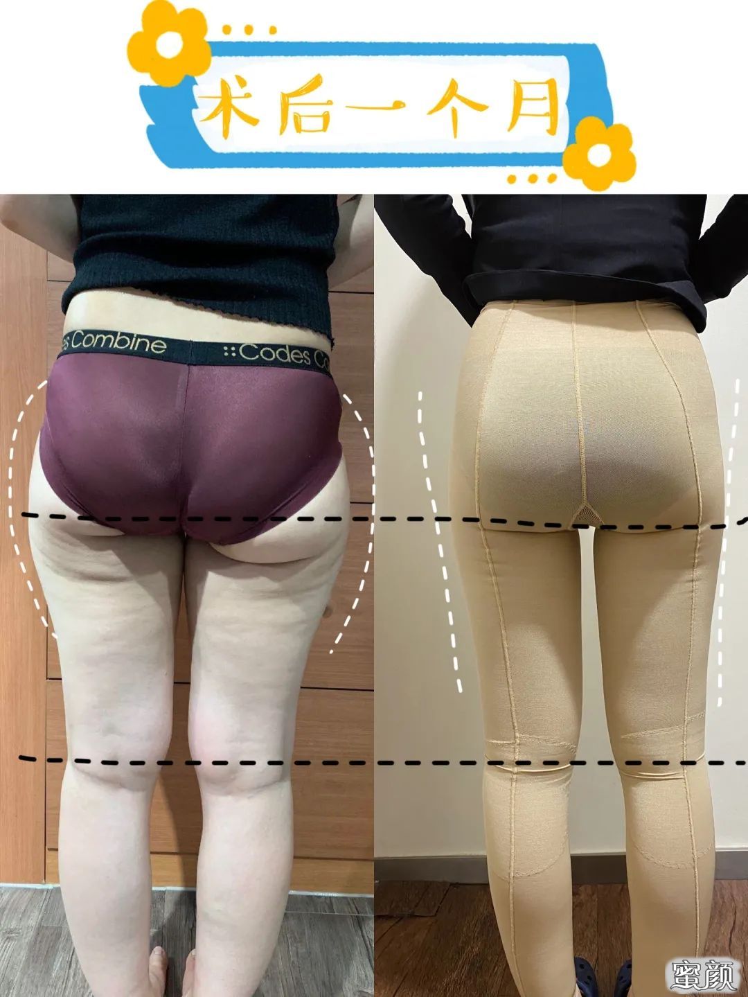 https://img.yiyiaimei.com/mnt/timg/200626/1115343132-10.jpg 案例图片