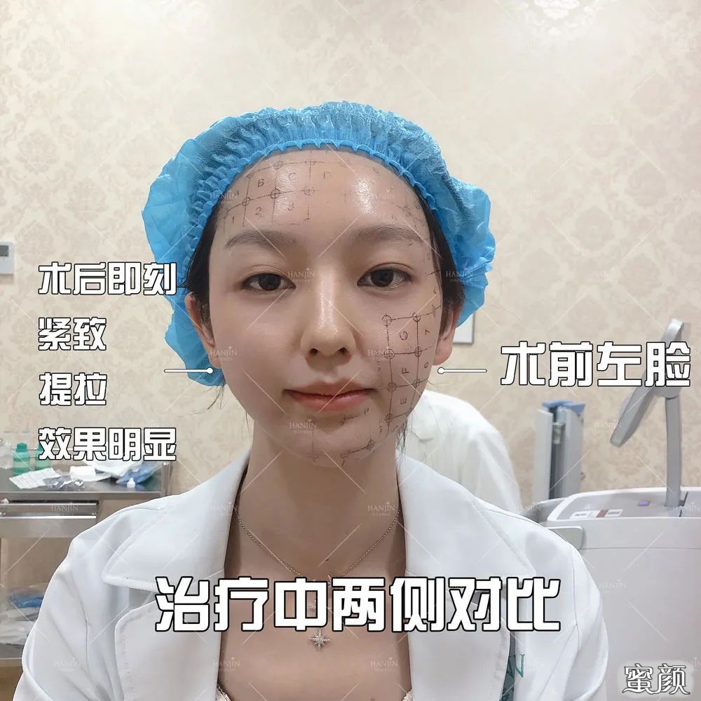 案例图片