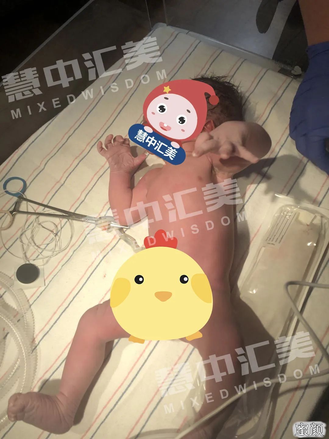 案例图片