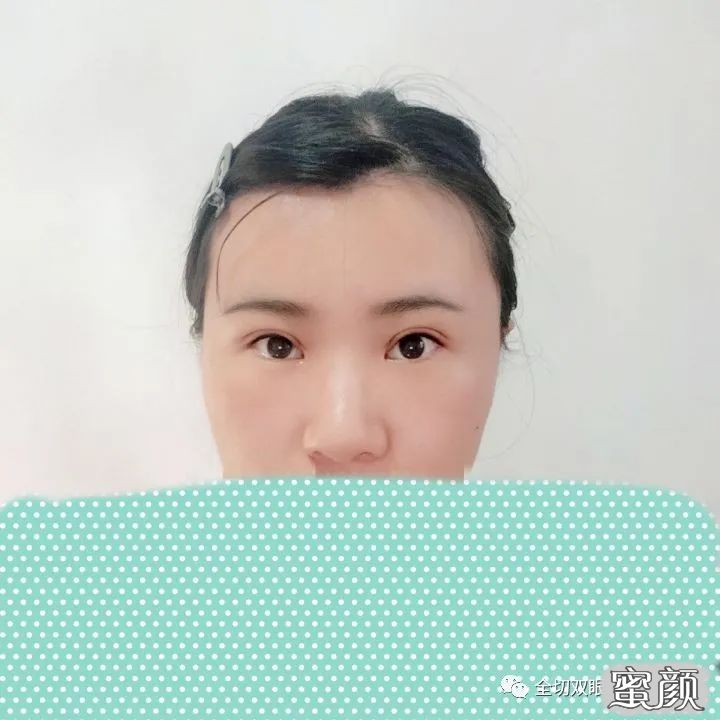 案例图片