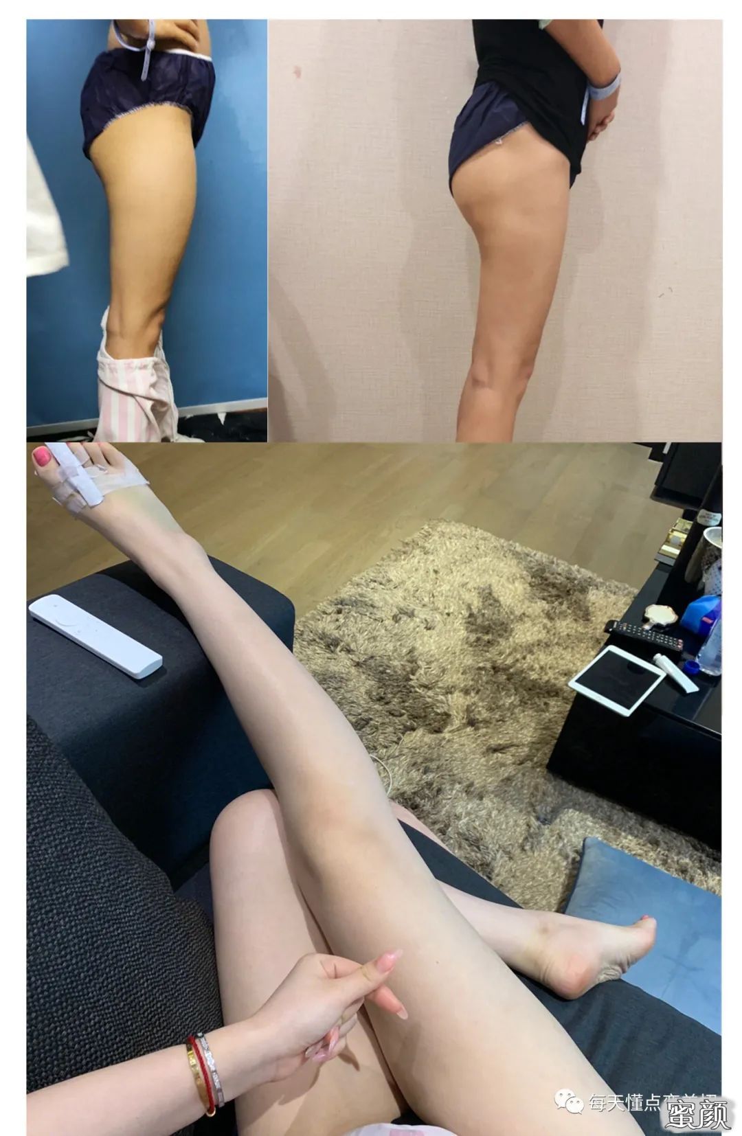 https://img.yiyiaimei.com/mnt/timg/200629/134I26230-9.jpg