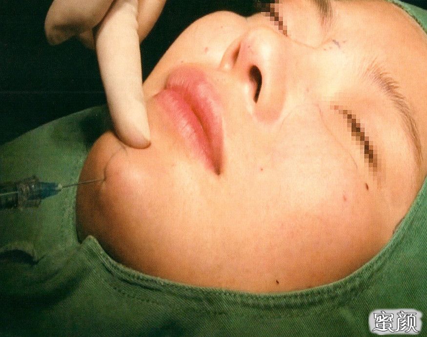 https://img.yiyiaimei.com/mnt/timg/200629/14053H5c-3.jpg