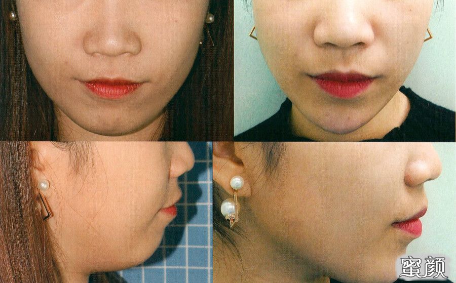 https://img.yiyiaimei.com/mnt/timg/200629/14060H3Q-5.jpg