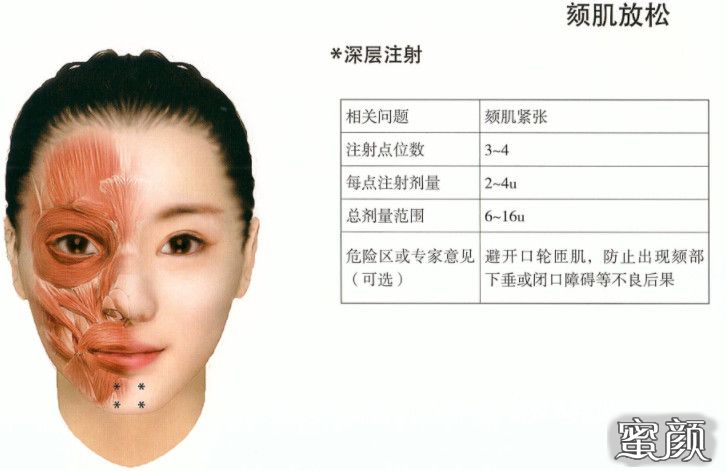 https://img.yiyiaimei.com/mnt/timg/200629/14060a106-6.jpg