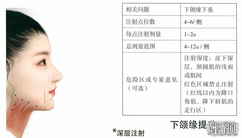 https://img.yiyiaimei.com/mnt/timg/200629/14061W1N-9.jpg