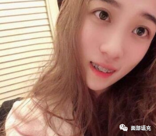 https://img.yiyiaimei.com/mnt/timg/200629/141610I47-2.jpg