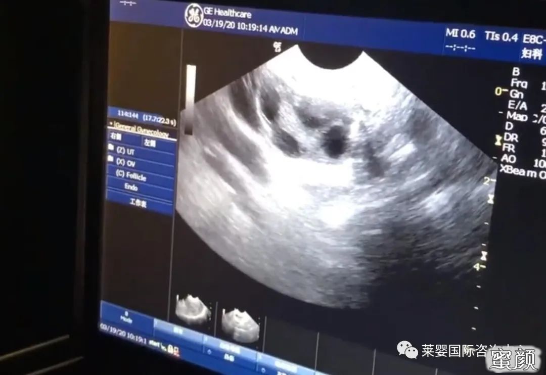 https://img.yiyiaimei.com/mnt/timg/200630/1409411L2-0.jpg 案例图片