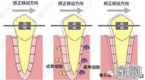 案例图片