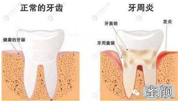 案例图片