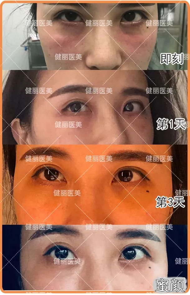 案例图片