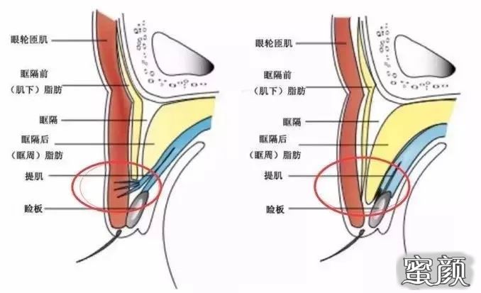 案例图片