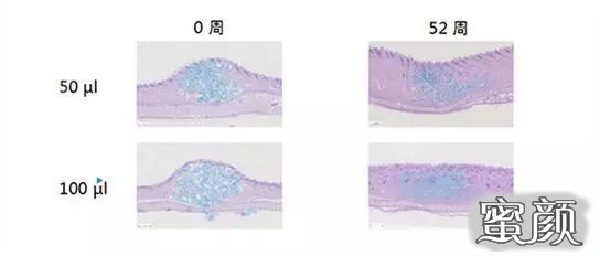 https://img.yiyiaimei.com/mnt/timg/200630/16334AU1-6.jpg