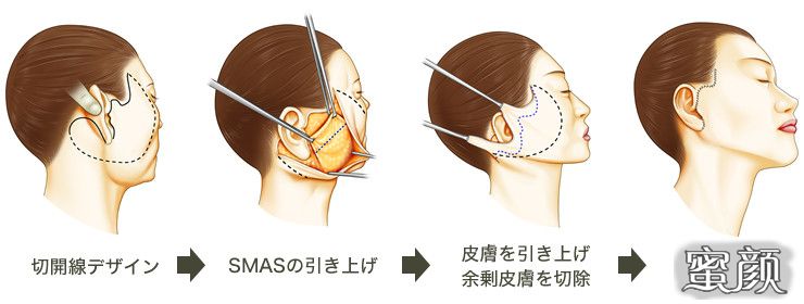 案例图片