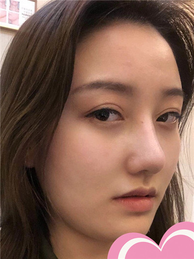 案例图片