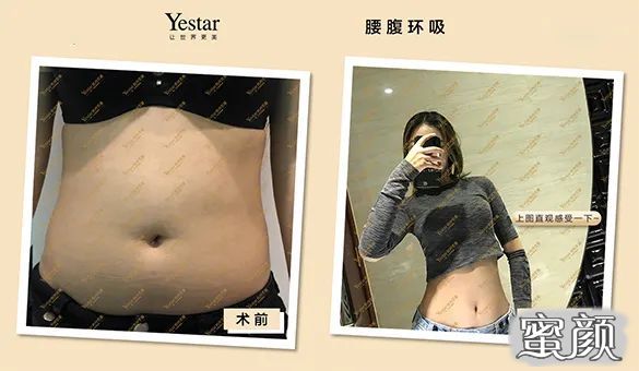 https://img.yiyiaimei.com/mnt/timg/200702/11145J612-2.jpg 案例图片