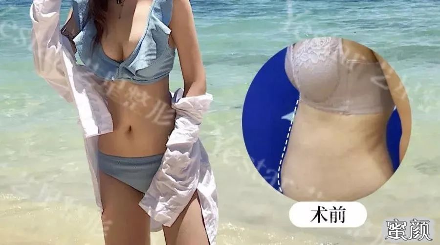 案例图片