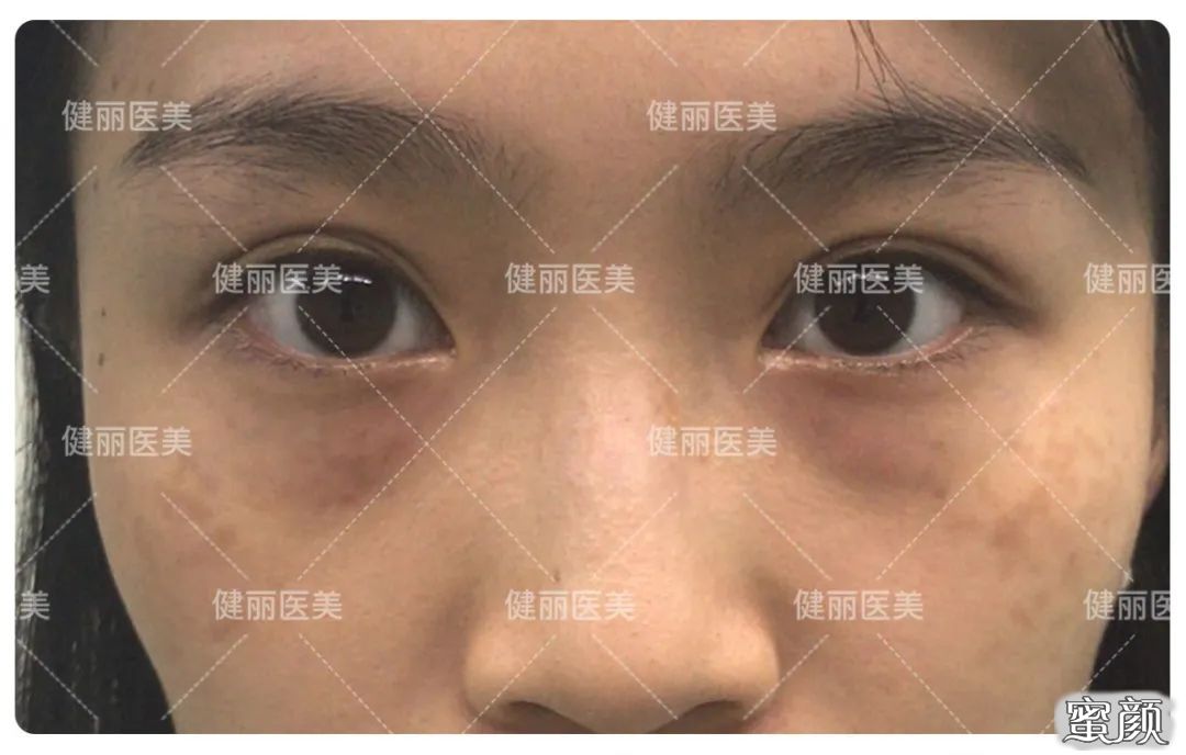 案例图片