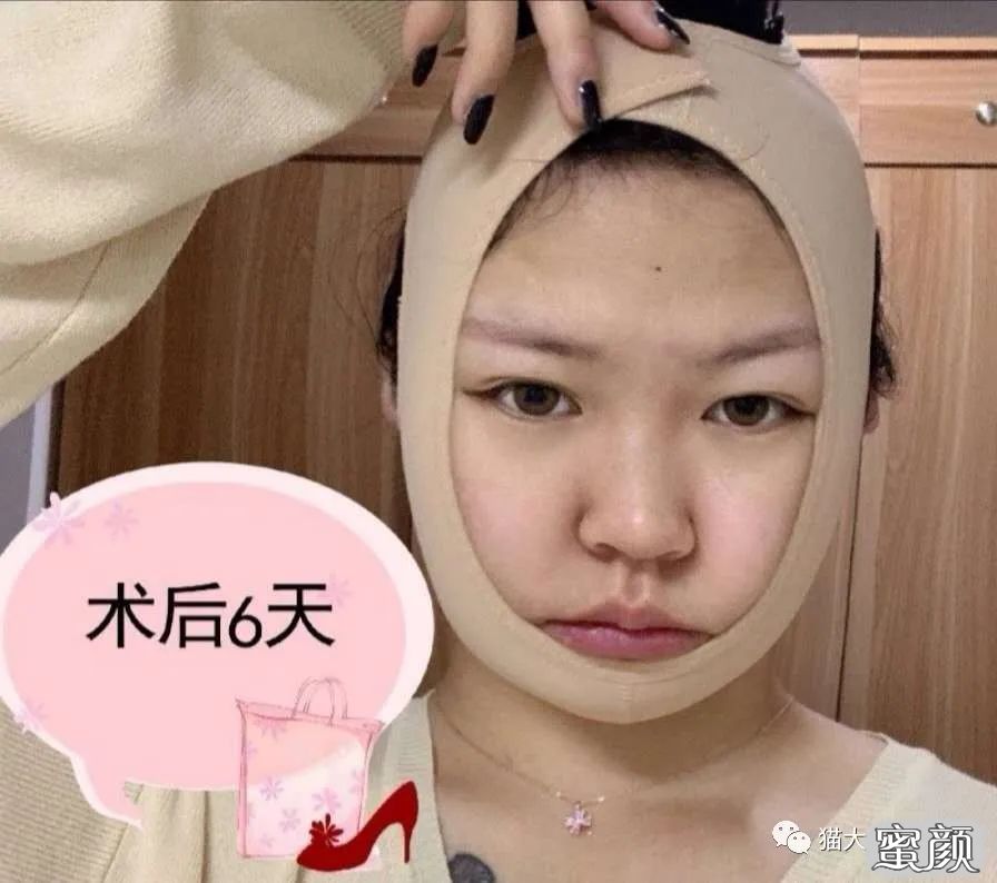 案例图片
