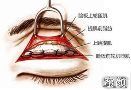 案例图片