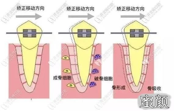 案例图片