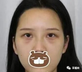 案例图片