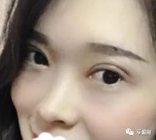 案例图片