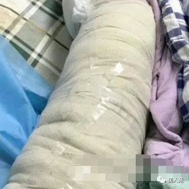 案例图片