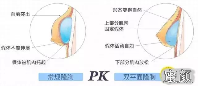 案例图片