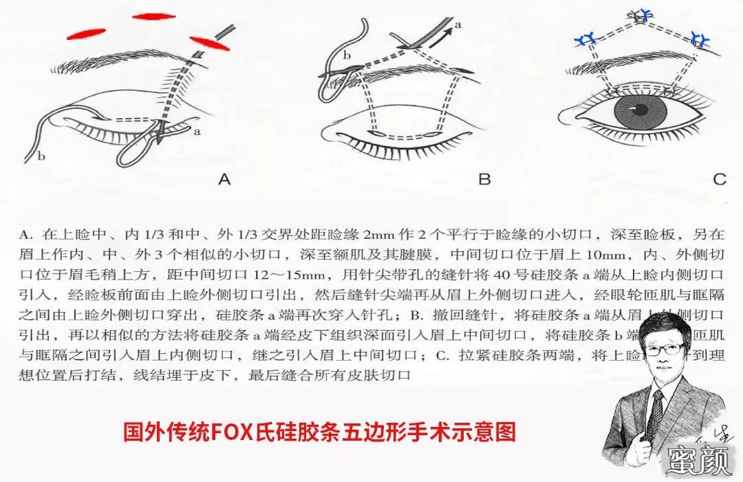 案例图片