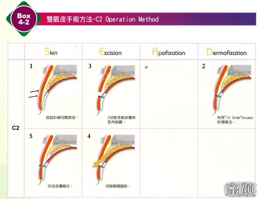 案例图片