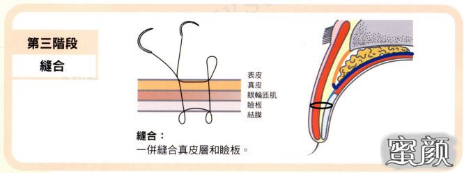 案例图片