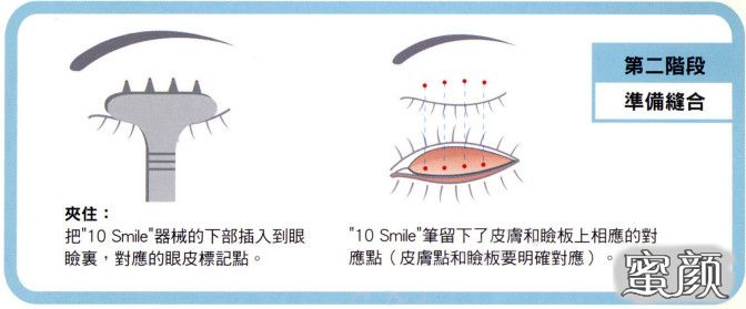 案例图片