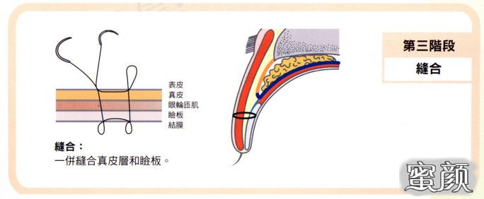 案例图片