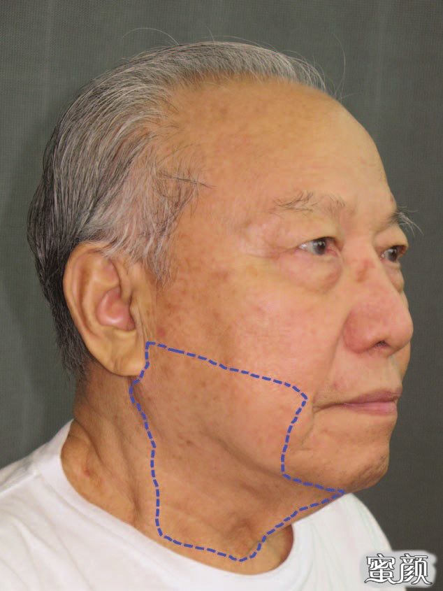 https://img.yiyiaimei.com/mnt/timg/200704/123P42P2-1.jpg