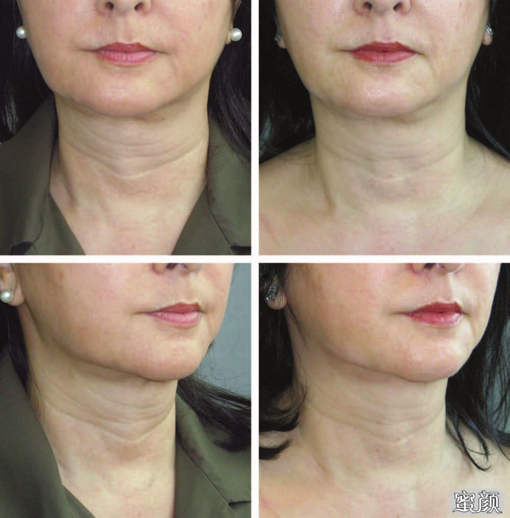 https://img.yiyiaimei.com/mnt/timg/200704/123RU927-6.jpg