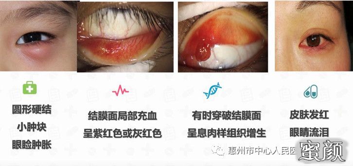 案例图片