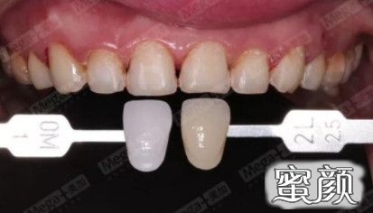 https://img.yiyiaimei.com/mnt/timg/200704/125Q523E-1.jpg