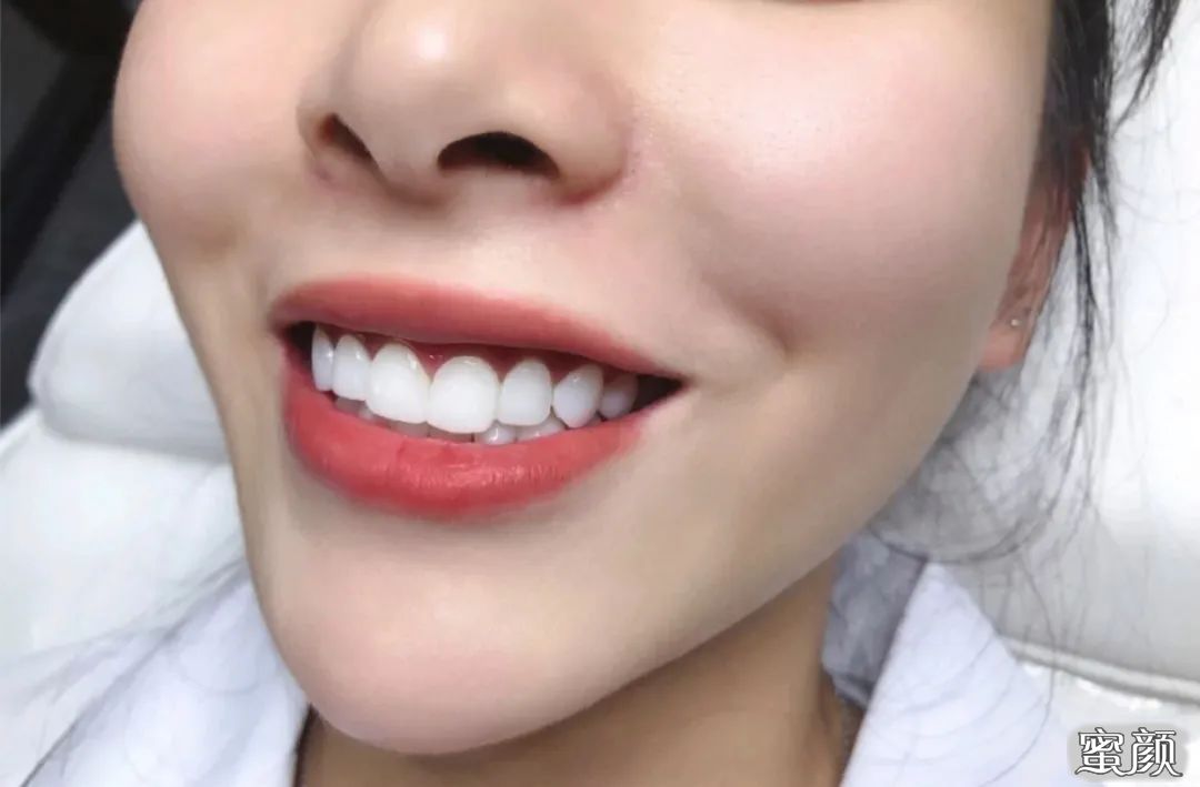https://img.yiyiaimei.com/mnt/timg/200704/130159E59-1.jpg 案例图片